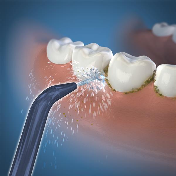 Classic Handheld Cordless Low-Pressure Tips - Pack of 2