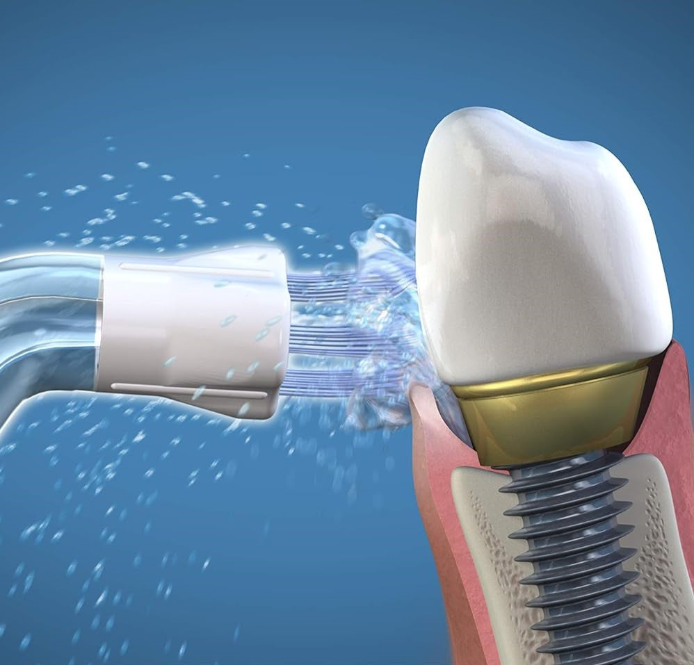 Plaque Seeker Tips - Pack of 2